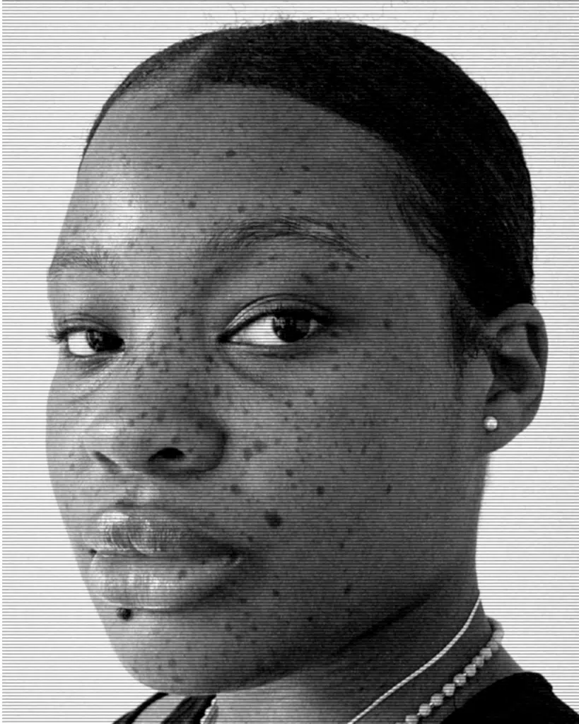 A black and white photo of a person with freckles.