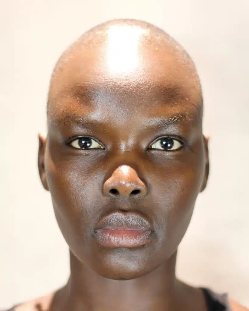 A woman with very large eyes and bald head.